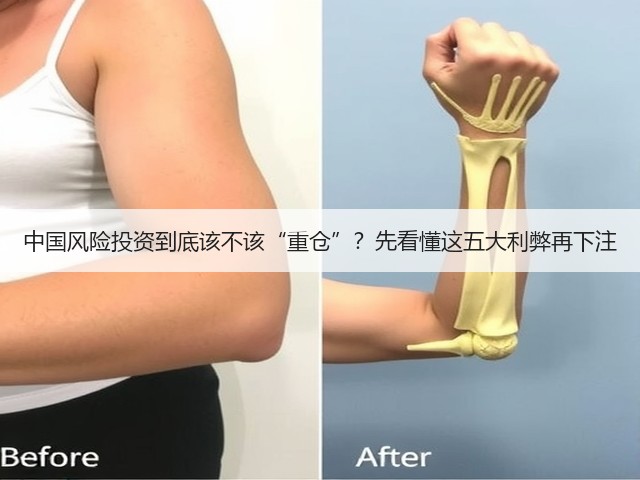 中国风险投资到底该不该“重仓”？先看懂这五大利弊再下注
